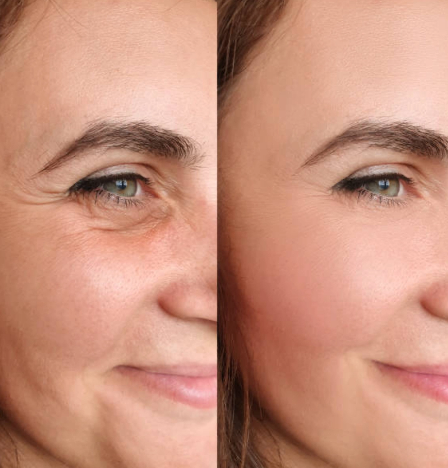 Hydrafacial-Maschine